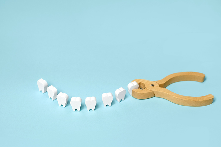 歯科治療自由診療の医療費の目安は？